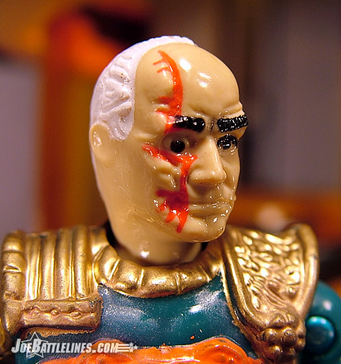 Cesspool's scars